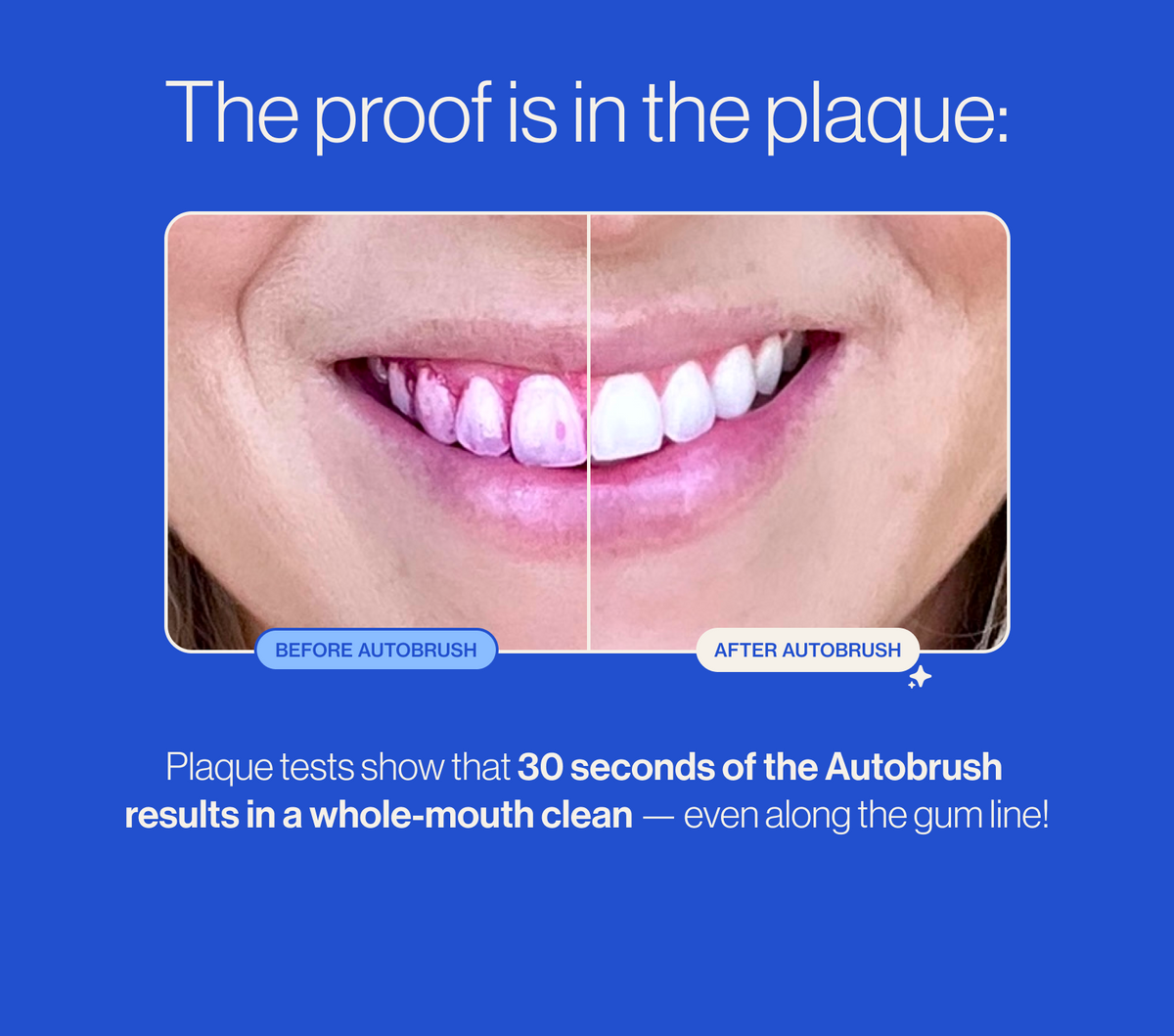 🦷 U-shaped electric soft-bristled toothbrush