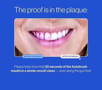 🦷 U-shaped electric soft-bristled toothbrush